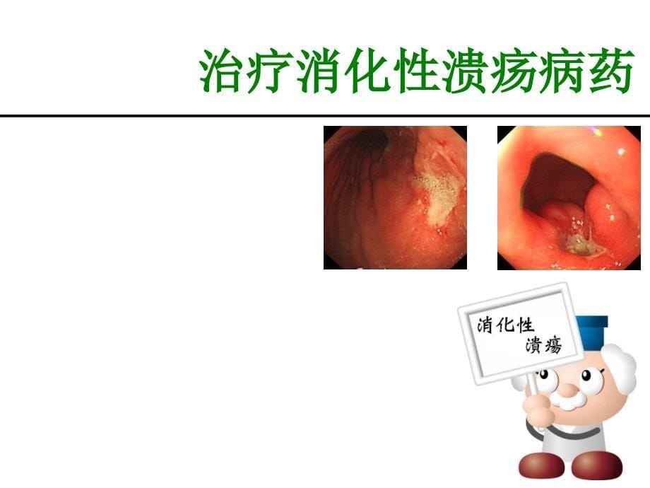 消化系统药理_第5页