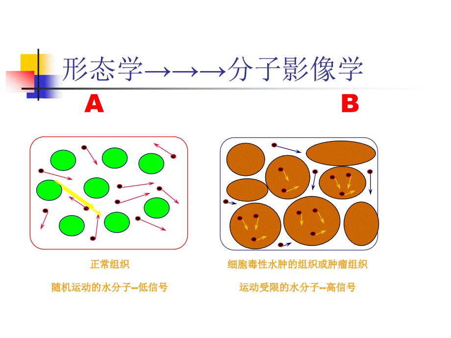 磁共振DWI的应用方案课件_第3页