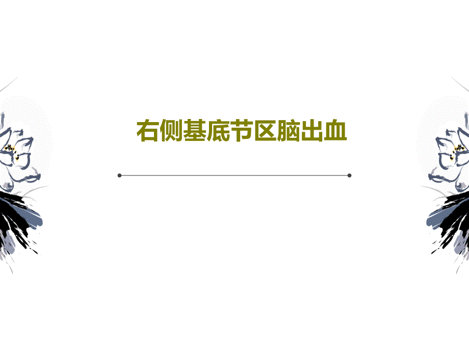 右侧基底节区脑出血30页PPT课件_第1页