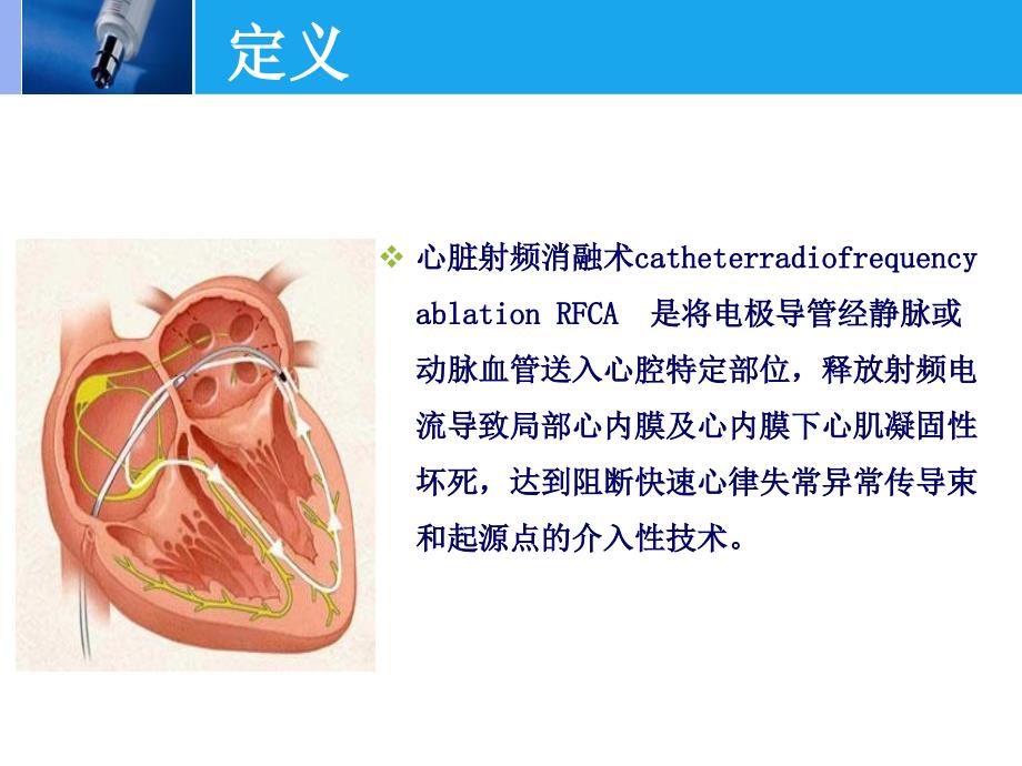 射频消融术的护理课件_第3页