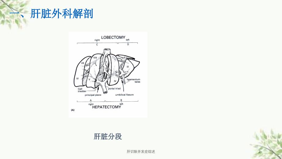 肝切除并发症综述课件_第2页