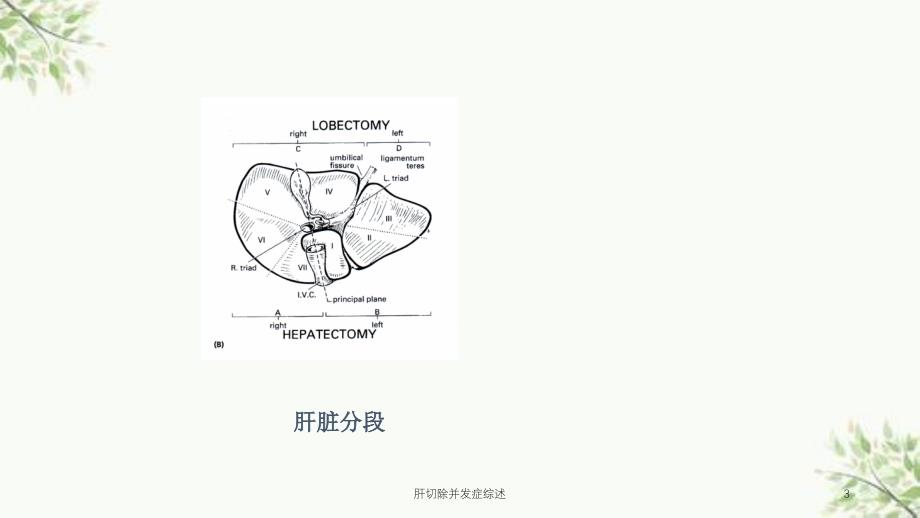 肝切除并发症综述课件_第3页