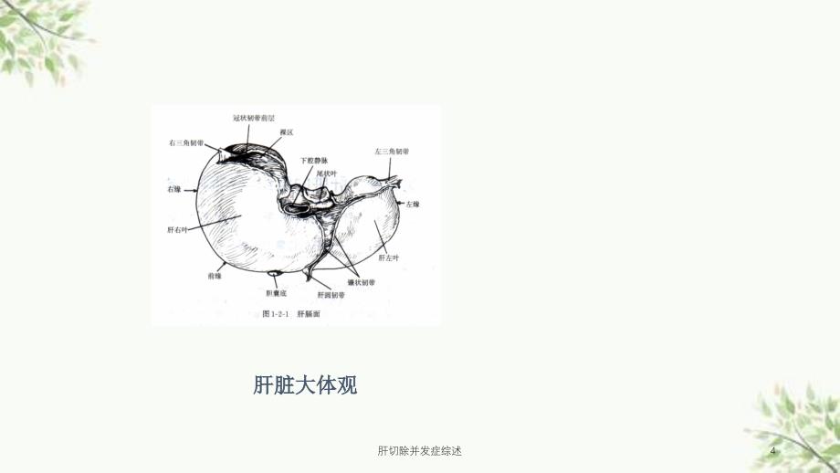 肝切除并发症综述课件_第4页