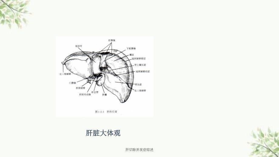 肝切除并发症综述课件_第5页