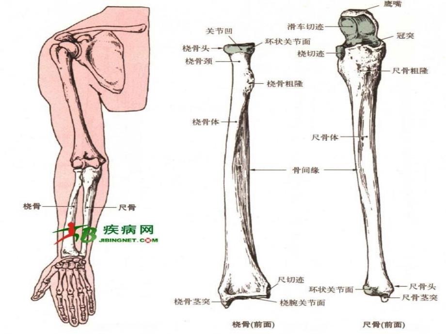 尺桡骨骨折的护理剖析_第4页