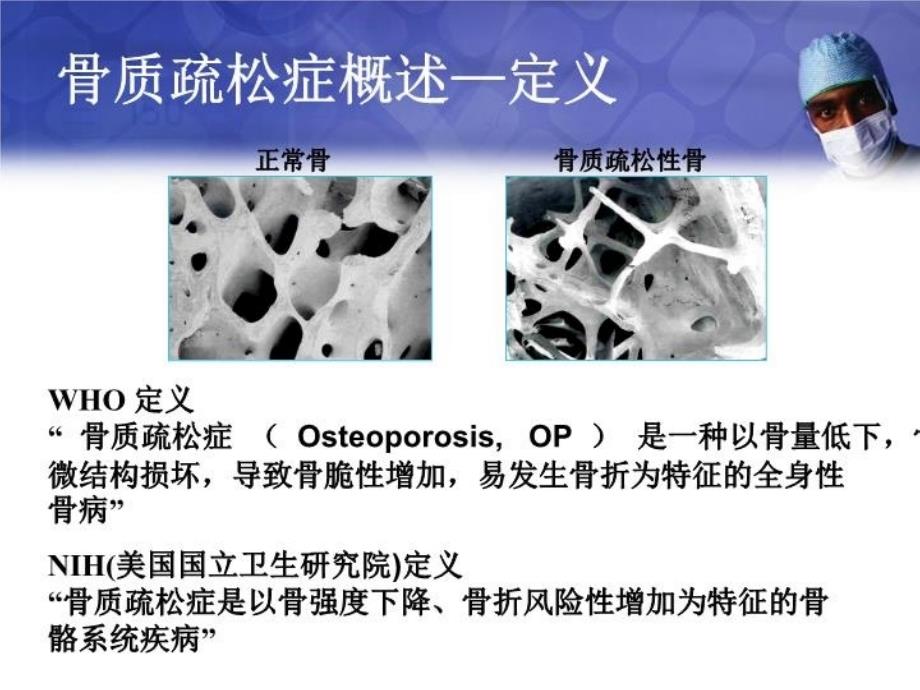 最新原发性骨质疏松症幻灯片_第4页