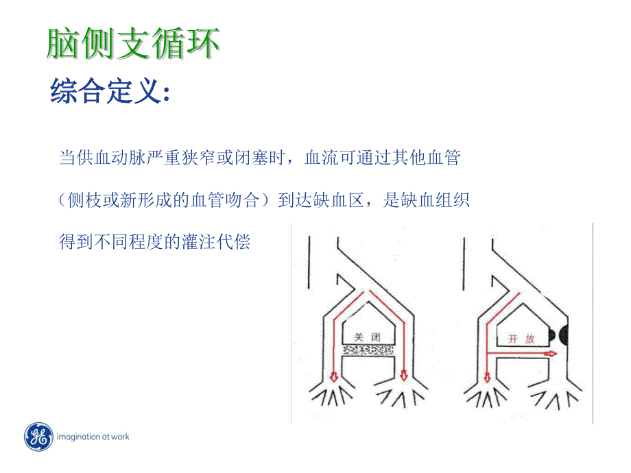 缺血性脑卒中的侧支循环评估_第2页