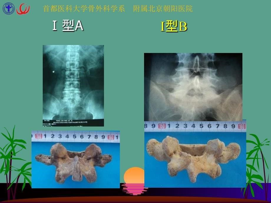 首都医科大学骨外科学系ppt课件_第5页