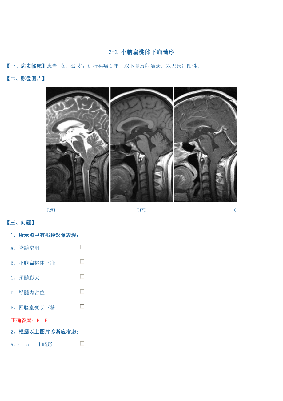 医学影像典型病例讨论：2 神经系统_第3页
