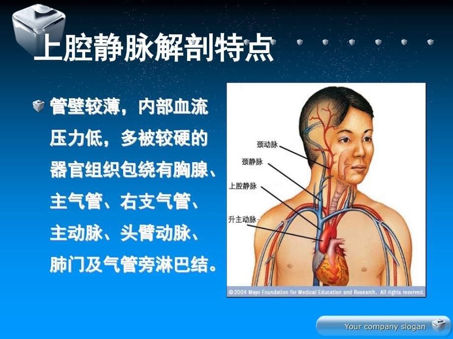 上腔静脉综合征护理.ppt_第5页