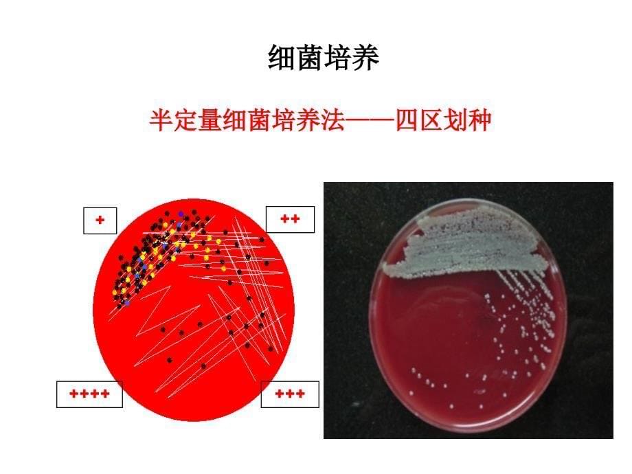 与抗感染治疗有关的几个问题ppt课件文档资料_第5页