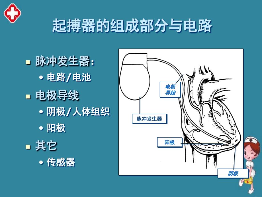 起搏器植入术后护理ppt_第3页