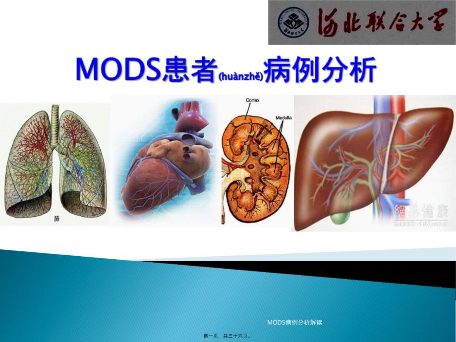 MODS病例分析解读课件_第1页