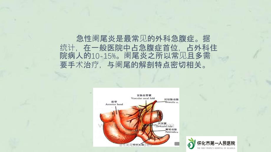 急性阑尾炎的CT诊断9课件_第3页