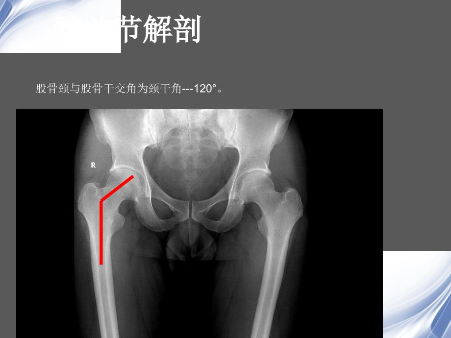 髋关节常见病变MR诊断精编ppt_第4页