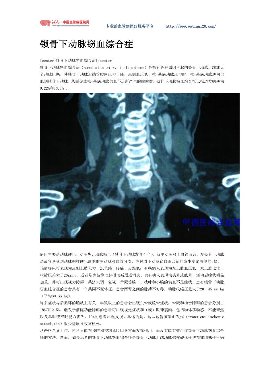 锁骨下动脉窃血综合症全程介绍.doc_第1页