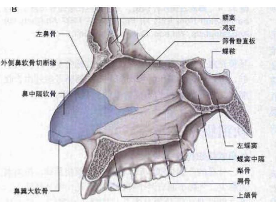 窦口鼻道复合体影像解剖及临床意义_第5页