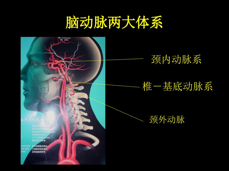 医学课件脑动脉的正常变异_第4页