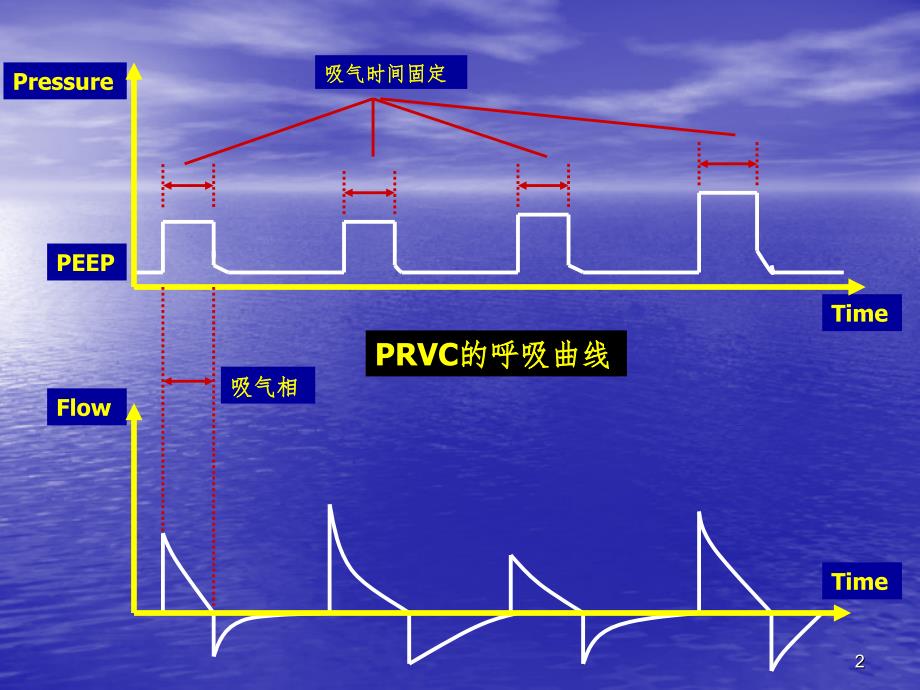 PRVC机械通气PPT课件_第2页