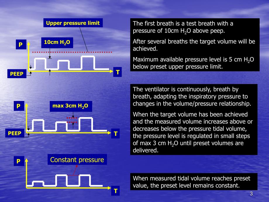 PRVC机械通气PPT课件_第3页