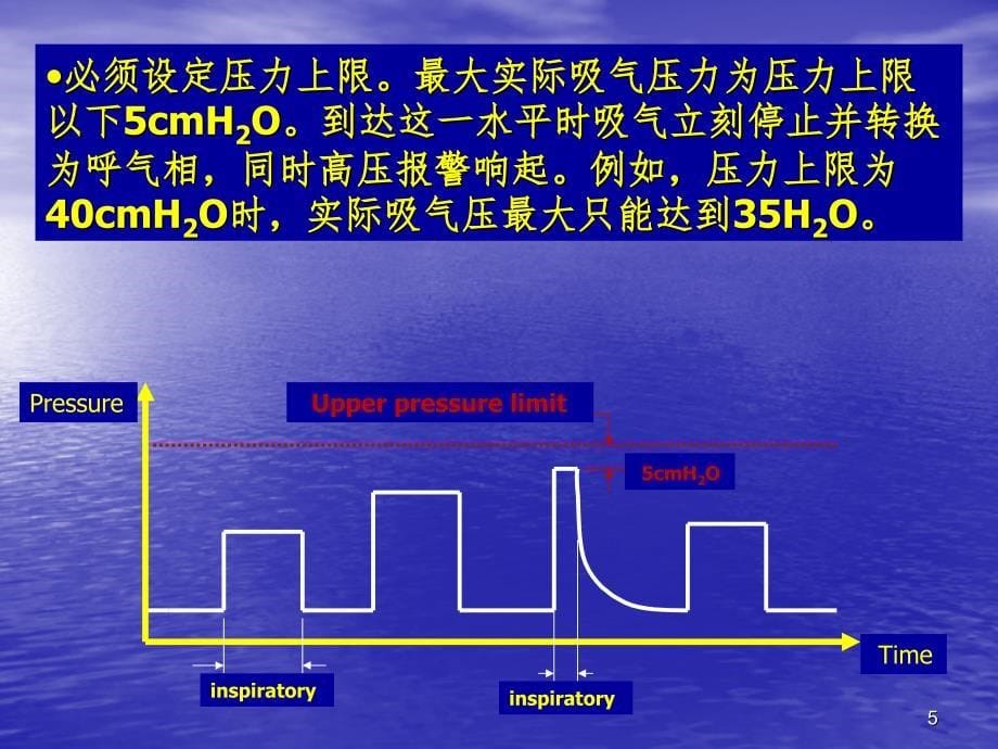 PRVC机械通气PPT课件_第5页