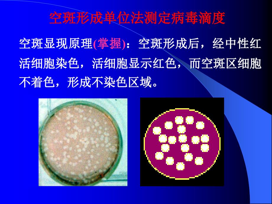 病毒滴度的测定课件_第4页