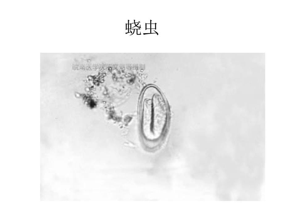 寄生虫实验考试图片整理_第5页