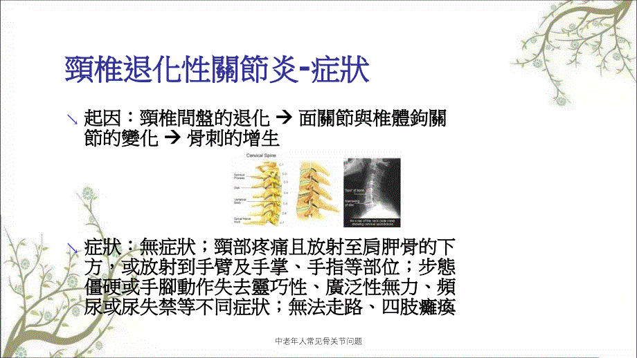 中老年人常见骨关节问题_第4页