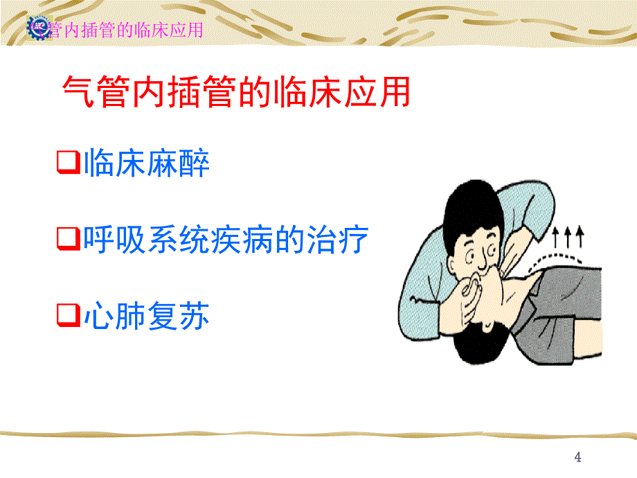 气管内插管的临床应用课件_第4页