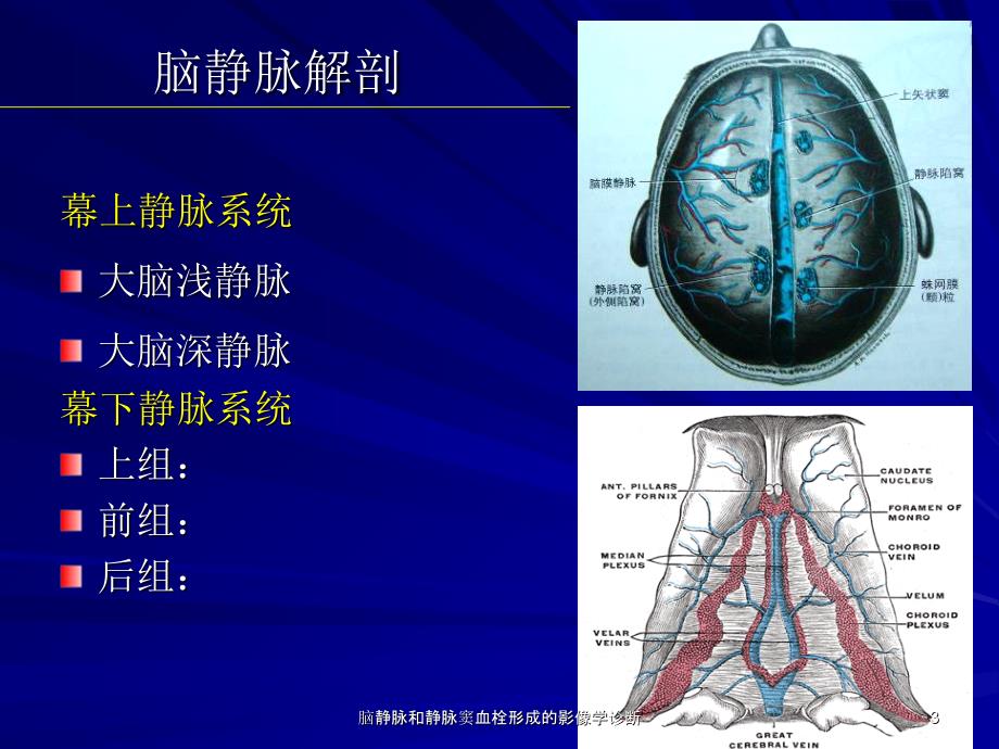 脑静脉和静脉窦血栓形成的影像学诊断课件_第3页