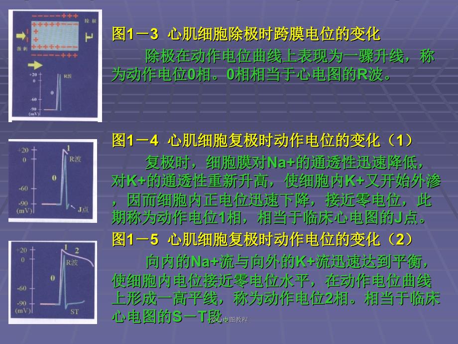 爱心电图教程课件_第4页