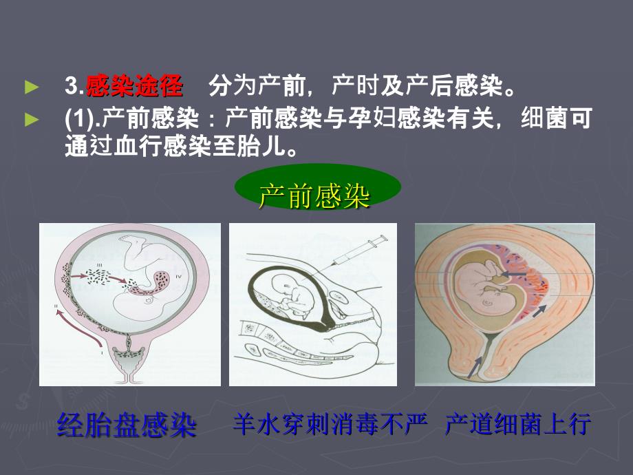 新生儿败血症课件.ppt_第4页