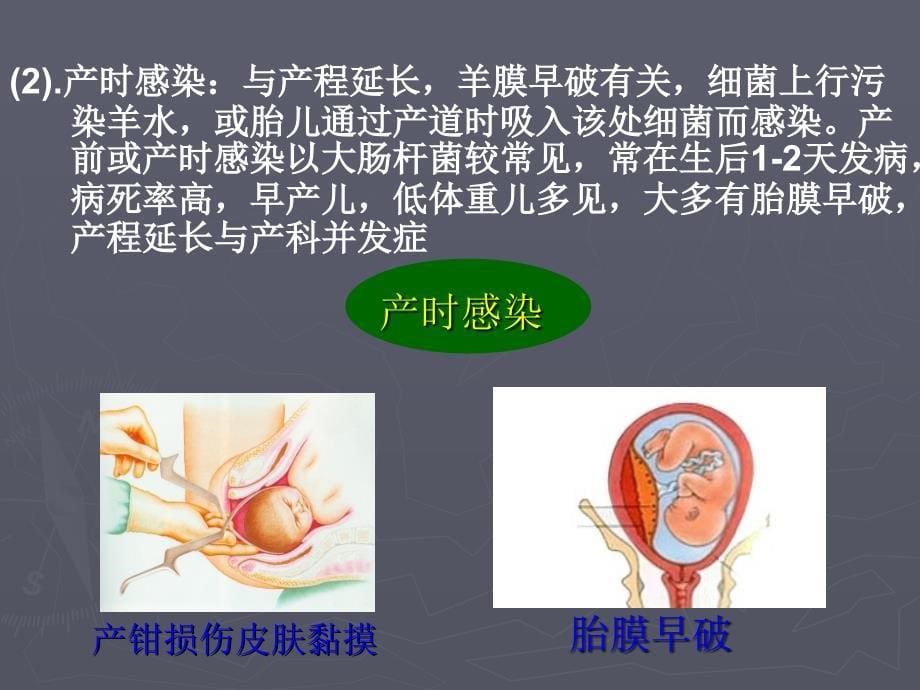 新生儿败血症课件.ppt_第5页