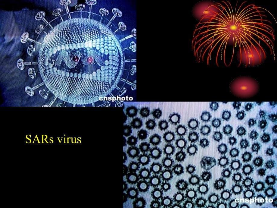 药理学教学课件：抗病毒药_第5页