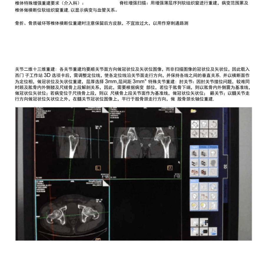 CT三维重建指南_第5页