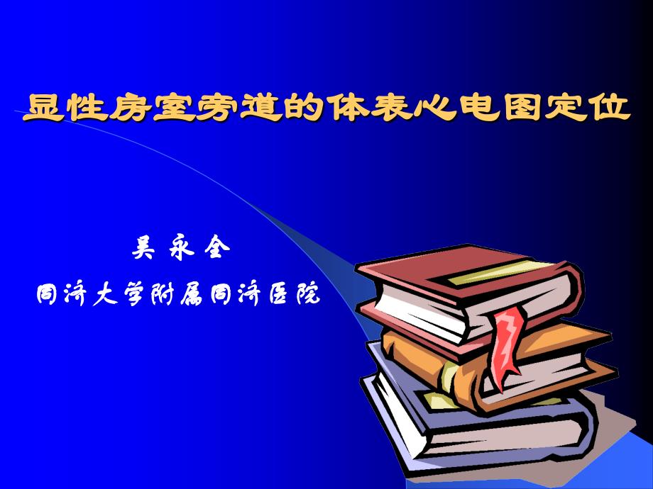 显性房室旁道的体表心电图定位_第1页