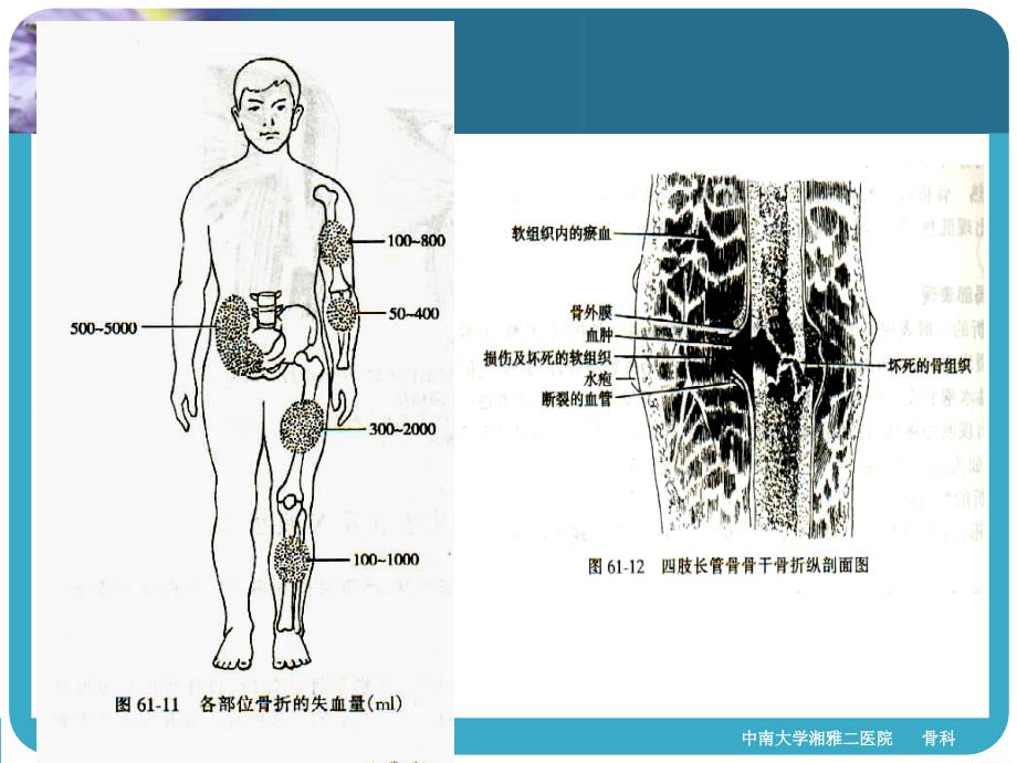 四肢骨折经典ppt课件文档资料_第2页