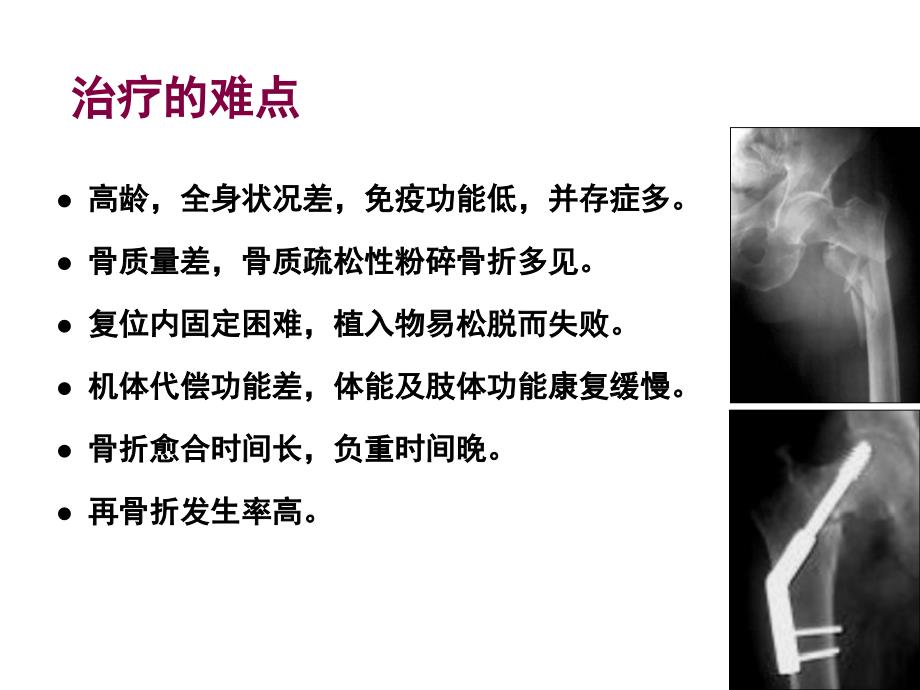 最新：[临床医学]裴福兴老年髋部骨折围手术期的评估与处理文档资料_第3页