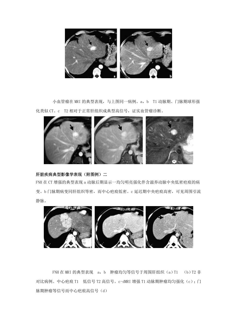 肝脏疾病典型影像学表现(附图例).doc_第2页