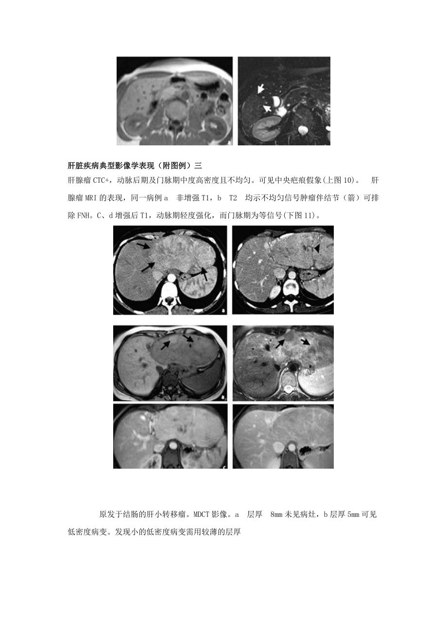 肝脏疾病典型影像学表现(附图例).doc_第4页