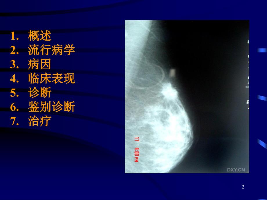 乳腺癌培训培训.ppt_第2页