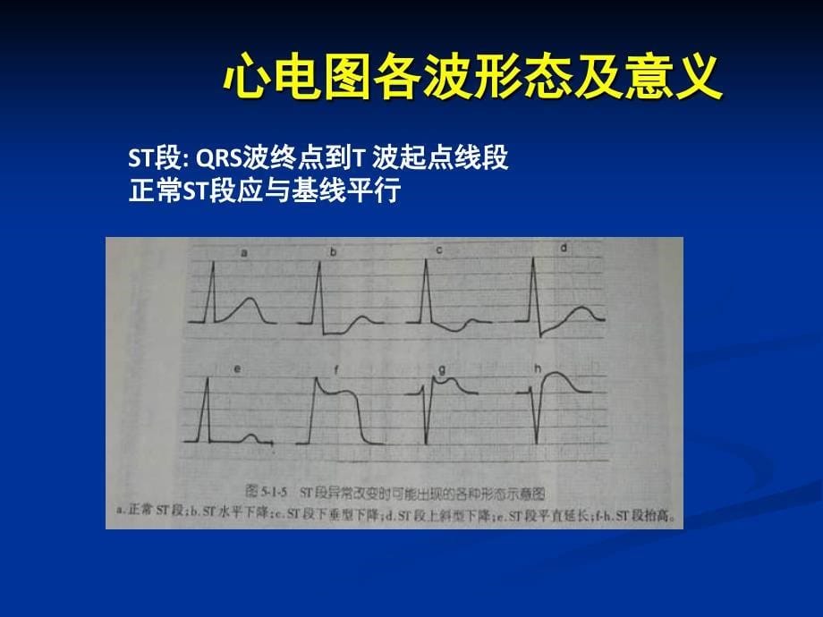 心电图_三基培训教程文件_第5页