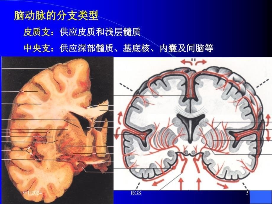 断层解剖脑血管1PPT课件_第5页