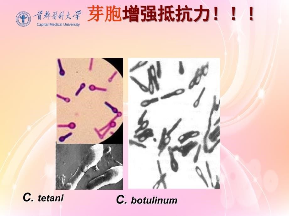 厌氧菌课件.ppt_第5页