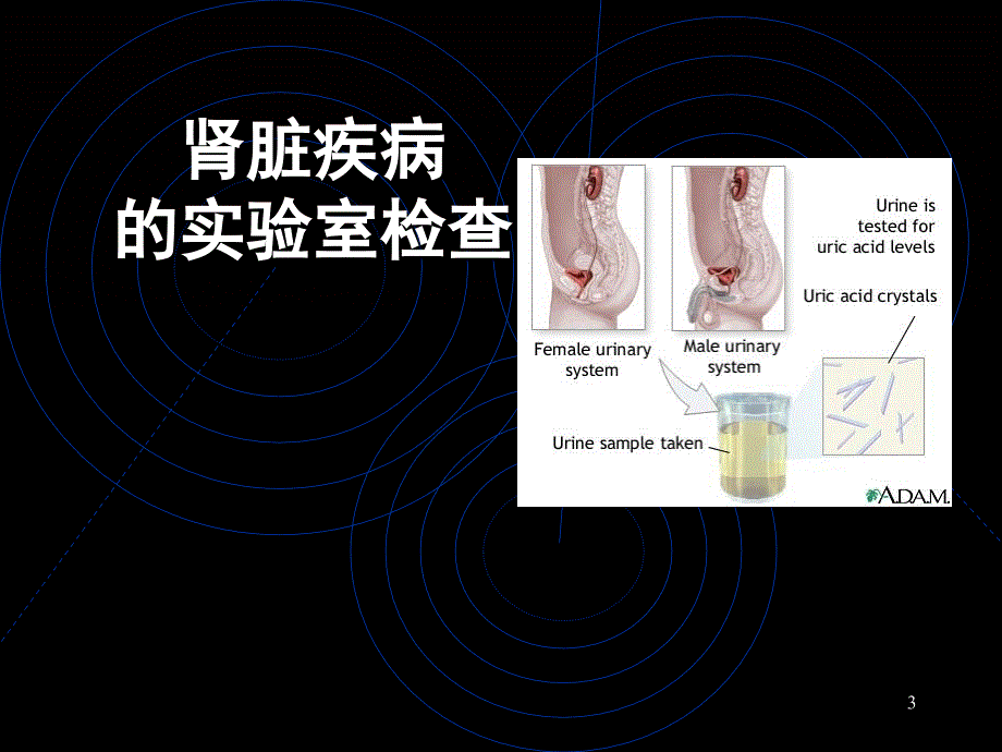 临检肾脏疾病_第3页