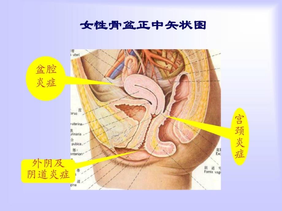 指南妇科炎症PPT课件2_第4页