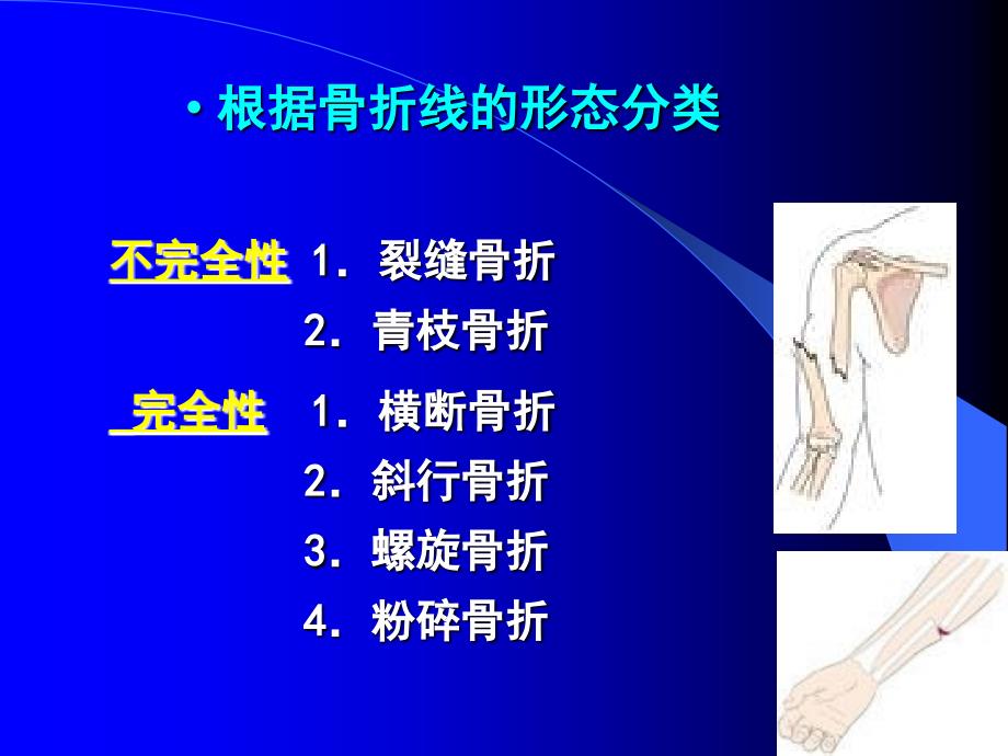 骨科病人的护理讲义_第3页