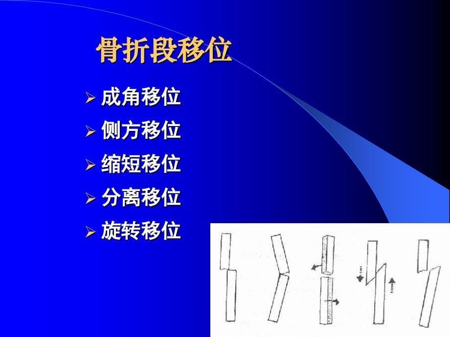 骨科病人的护理讲义_第5页