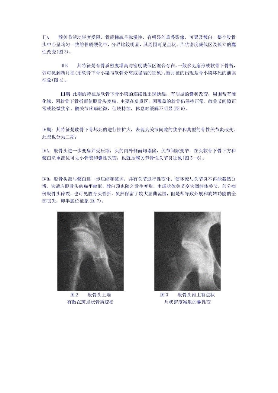 股骨头坏逝世的诊断要点及临床表现11790[整理版].doc_第5页