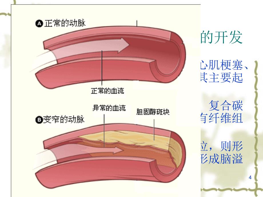 第七章-改善当代“文明病”功能性食品的开发课件_第4页